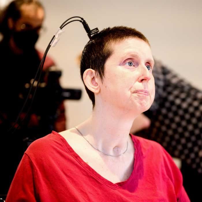 Brain Implant Restores Speech After 18 Years